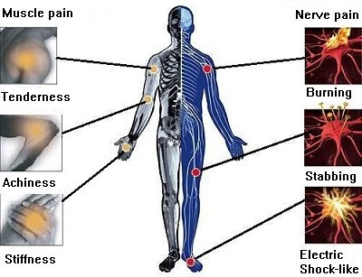 Acupuncture