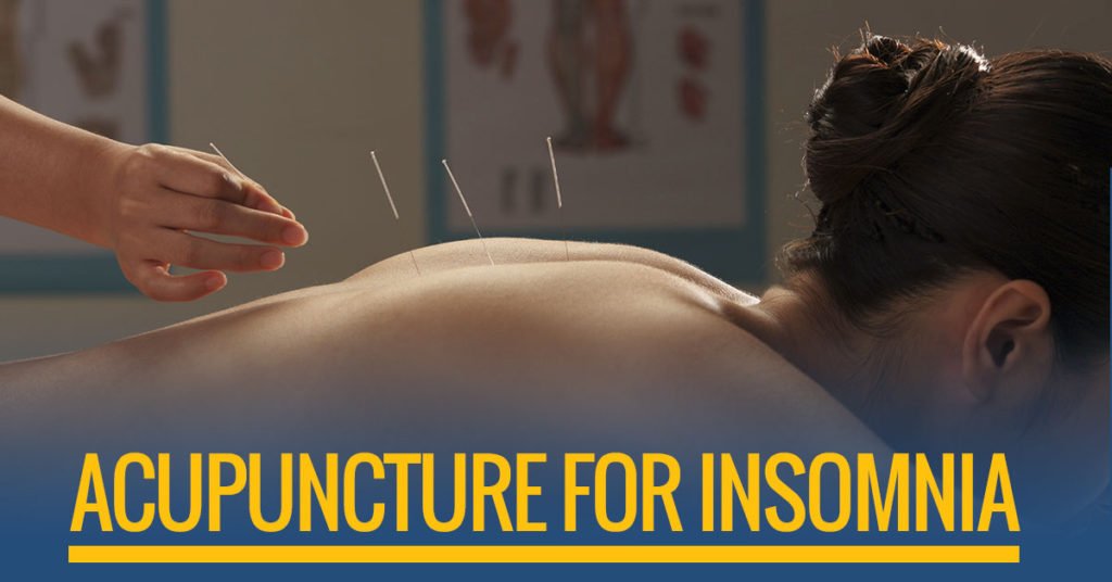 Acupuncture for good sleeping